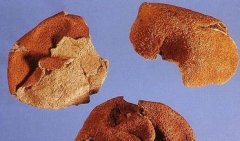 游资炒作陈皮收藏